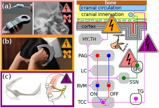 neuromodulation-abc